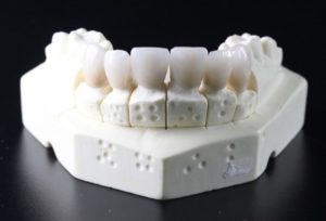 teeth acyclic 